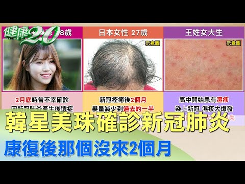 韓星美珠確診新冠肺炎 康復後那個沒來2個月 健康2.0