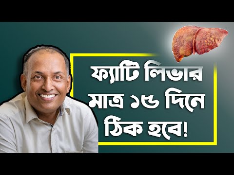 ফ্যাটি লিভার কি? কেন হয়? প্রাকৃতিকভাবে ফ্যাটি লিভার থেকে বাঁচার উপায় কি? by Alamgir Alam
