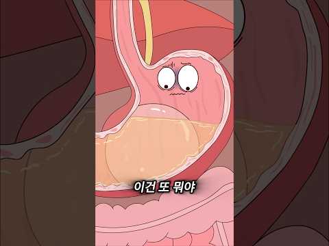 위가 알려주는(?) 웃긴 다이어트 방법