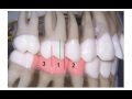 Understanding Occlusal Classification Concepts