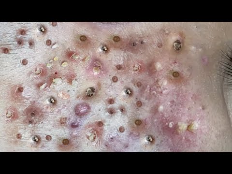 Most Relaxing and Satisfying with An Beauty TV Videos #2000