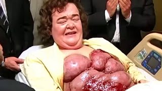 The Tragedy Of Susan Boyle Is So Sad