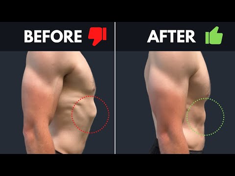 Fix Rib Flare In 1 Exercise (fast results)
