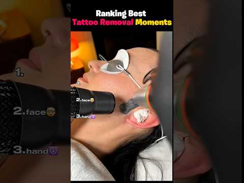 Ranking Best Tattoo Removal Moments