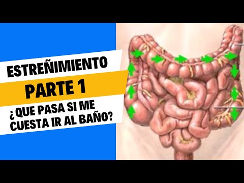 ¿Qué pasa en mi interior cuando me cuesta ir al baño?-Pólipos, divertículos, tumoraciones...