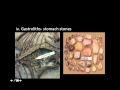 Fossil Evidence and Types