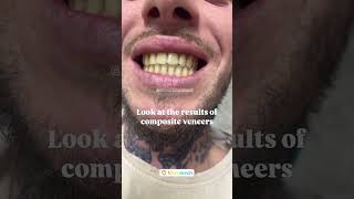 SMILE ART MARRAKECH 🇲🇦 #dental #dentalcare #dentist #dentista #dentiste #smile #edm #fyp #ai