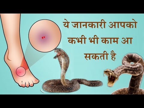 सांप के काटने पर तुरंत करें ये उपाय, इस उपाय से किसी की जिंदगी बच सकती है