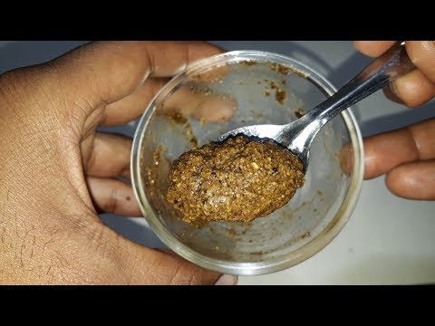 15 दिनों में पाइए हाइड्रोसील से छुटकारा || Home Remedy For Hydrocele || Hydrocele Ka Gharelu Ilaj ||