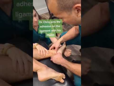 Got chronic ankle sprains and a pinch in the front of the ankle? Meet your posterior tibiotalar lig