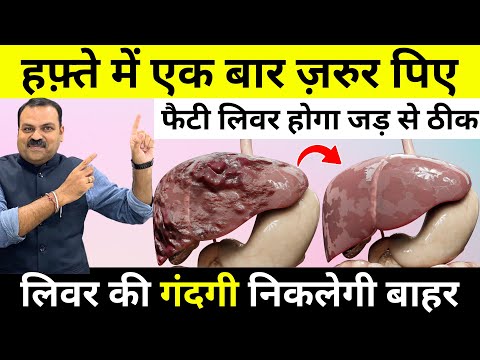 फैटी लिवर के लिए रामबाण घरेलु इलाज | लिवर Detox कर इसे Strong कैसे बनाएं? | Fatty Liver Treatment