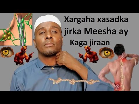 Xargaha xasadka jirka meesha ay kaga jiraan nolosha ciriiri kadhigay Burqaha jirkaada kujira ogow