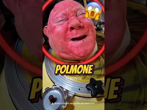 HA VISSUTO 71 ANNI IN UN POLMONE DI FERRO 😱 #curiosità #informative
