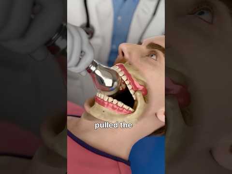 How Light Bulb Can Trap Jaw😮