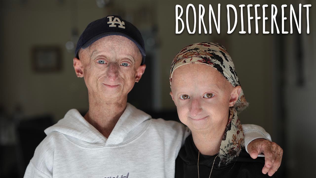 The people who age too fast - born different