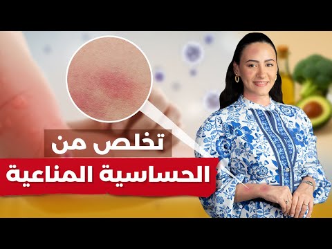 الأسباب الخفية وراء الحساسية المناعية.. ومضادات الهيستامين ليست الحل!