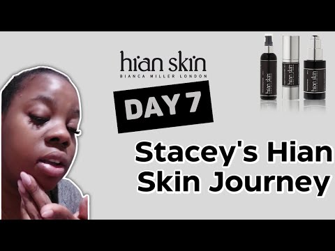 Stacey's Hian Skin Journey Day Seven - Hian Skin - Bianca Miller London