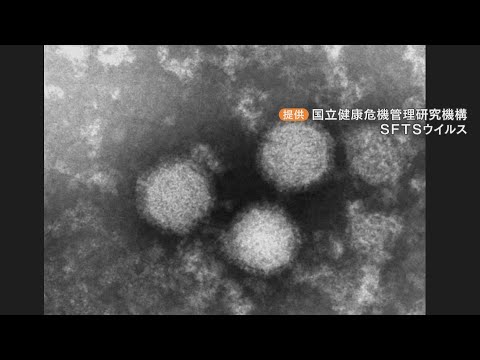 マダニ感染症「SFTS」広がる 愛知で2人死亡 草むらで除草作業した50代女性も 豊田市