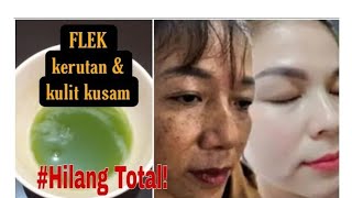 2 BAHAN SAJA ‼️BISA LUNTURKAN FLEK HITAM & KERUTAN DIWAJAH//WAJAH AUTO MULUS GLOWING KEMBALI 