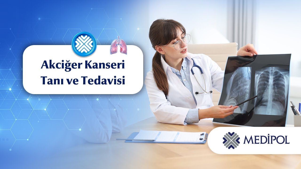 Akciğer Kanserinde Erken Tanı Hayat Kurtarır!