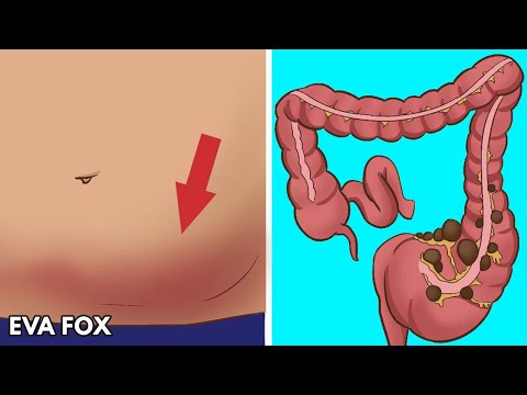 Teas to help ease digestive pains, bloating, and constipation