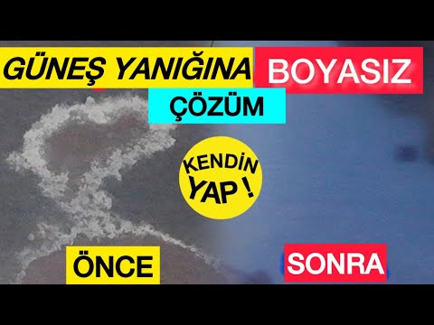 GÜNEŞ YANIĞINA BOYASIZ ÇÖZÜM, VERNİK SÖKÜCÜ ve  PASTA-POLİSH-CİLA  İLE ARABAYI BOYATMAYA GEREK YOK