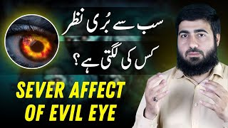 How To Remove Evil Eye? | Shadeed Nazar Kis Ki Lagti Hai? | Treatment | Signs | Hafiz Wasil | Nazar
