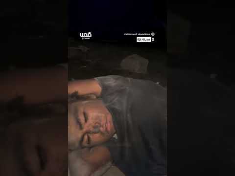 ..طفل يعاني الألم الشديدجراء إصابته بقصف الاحتلال في ظل انعدام الخدمات الصحية بفعل الحصار والحرب.