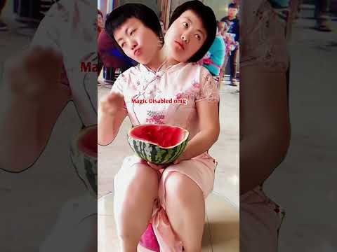 Tasbih song - conjoined twins sister#godblessyou#ytshorts#short#viralshort#tiktokviral