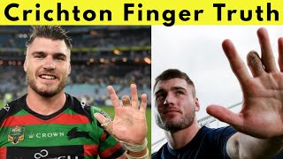 Angus Crichton Finger Injury - The Truth Behind His Amputation