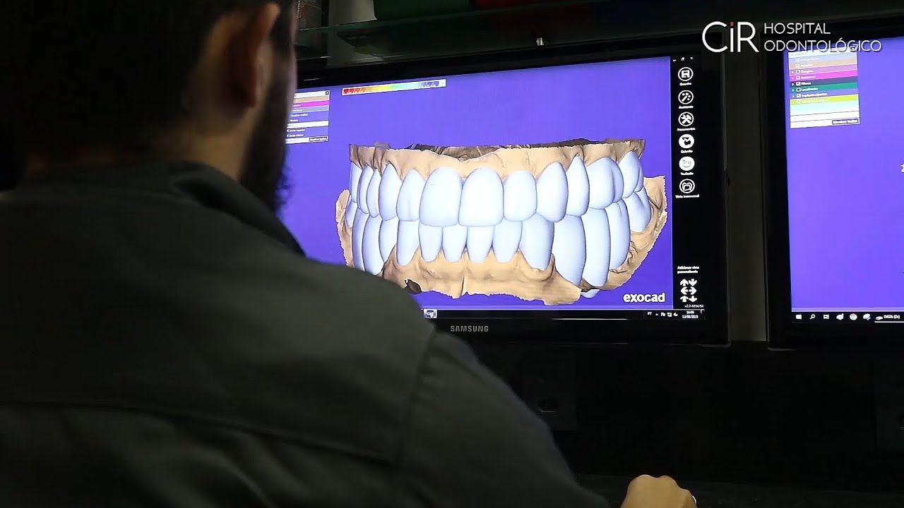 Reabilitação Funcional/Estética completa do sorriso