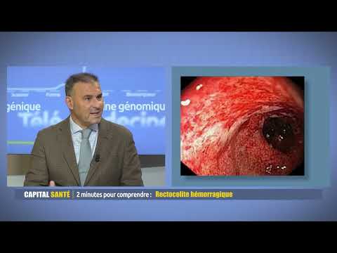 Rectocolite hémorragique - 2 minutes pour comprendre