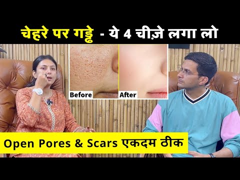Open Pores And Scars Treatment Ft.@upasanakiduniya | Open Pores Home Remedy | Himanshu Bhatt