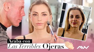 ¿Cómo cubrir completamente las ojeras? | Alfonso Waithsman