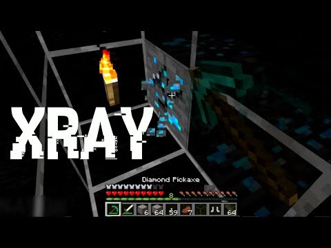 x ray for 1.12 2