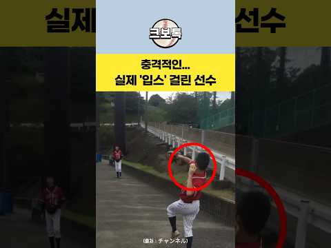 충격적인 실제 '입스' 증상