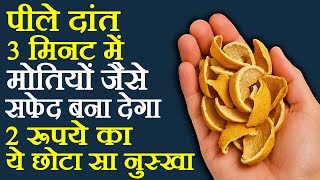 पीले दांत साफ करने का तरीका - Peele Dant Saaf Karne Ka Tarika - How To Whiten Yellow Teeth