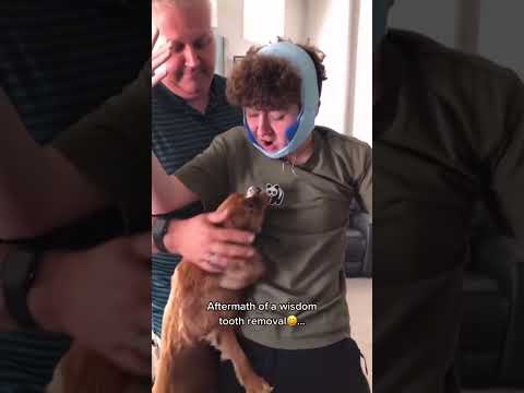 Reactions after wisdom tooth extraction.😂#funny #funnyvideos #wisdomteeth #foryou #tooth