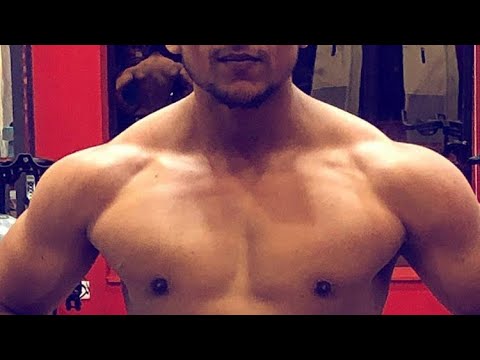 Q and A on Gynecomastia