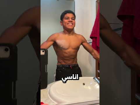 نهاية الاستعراض دايماً كارثية! 🤦♂️😂 #GoldenTales #shorts #مواقف_مضحكة #عيد #استعراض #فشل_مضحك
