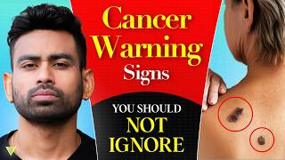 6 Warning SIGNS You're at Risk for Cancer