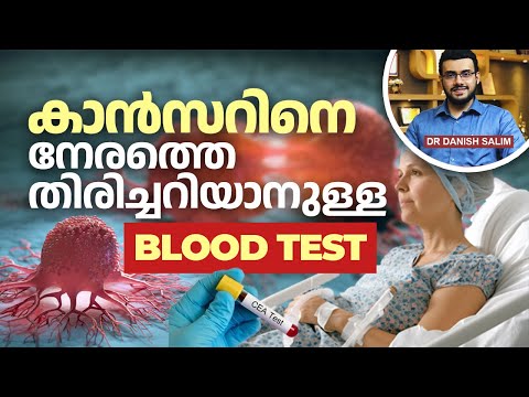 2330 : കാൻസർ മുൻകൂട്ടി അറിയാനുള്ള വഴികൾ . |  Early Detection & Tumour Markers Explained.