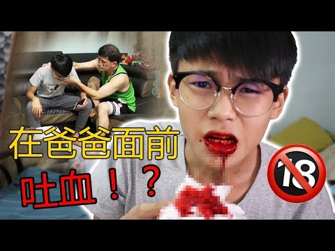 【整人PRANK】在爸爸面前吐血！爸爸当场竟然...