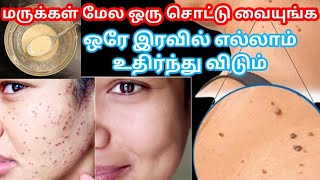 ஒரே இரவில் மருக்கள் உதிர / Remove Skin Tag / Maru poga Tips In Tamil