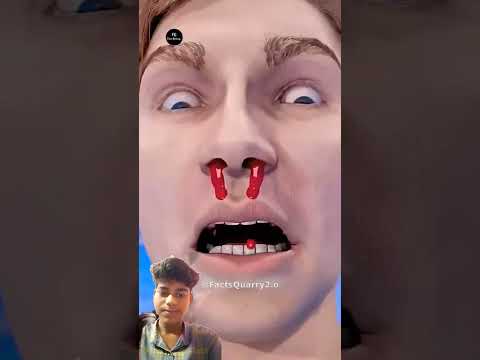 😃नाक का खून रोकने का तरीका 😃