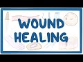 Wound Healing Processes and Concepts