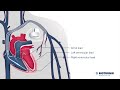 Cardiac Resynchronization Therapy Concepts