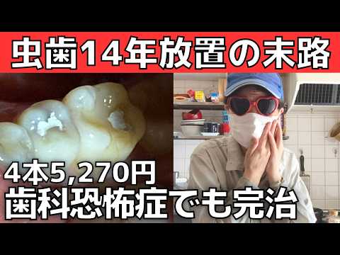 【衝撃】虫歯14年放置の末路｜5270円で4本治療できたワケとは？【歯科恐怖症・無痛治療】