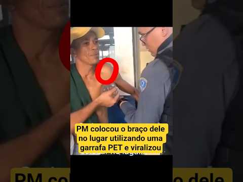 Luxação de Ombro: Sintomas, Causas e Tratamento #shorts #viral #ortopedia