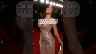 Celebrities before and after plastic surgery #celebrity